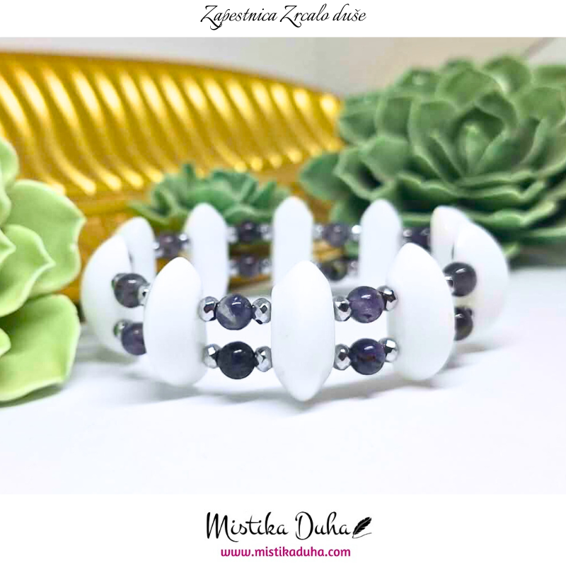 zapestnica - 2025-12-07T125539.377