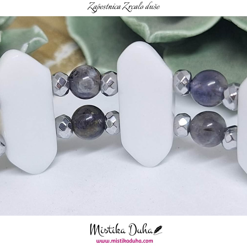 zapestnica - 2025-12-07T125601.409