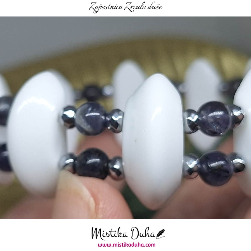 zapestnica - 2025-12-07T125619.132