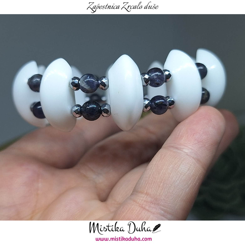 zapestnica - 2025-12-07T125703.307