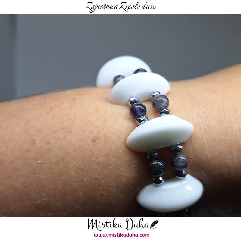 zapestnica - 2025-12-07T125711.529